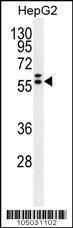 Anti-GPC3 Rabbit Polyclonal Antibody (FITC (Fluorescein))