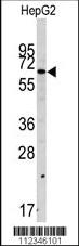 Anti-SWAP70 Rabbit Polyclonal Antibody