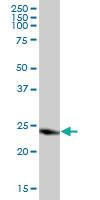 Anti-CLIC3 Mouse Polyclonal Antibody