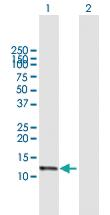 Anti-NDUFA13 Rabbit Polyclonal Antibody