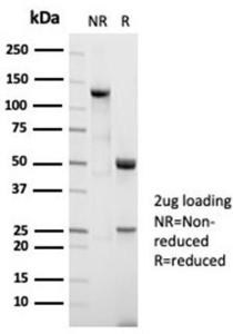 Anti-Nucleolin Rabbit Recombinant Antibody [clone: NCL/7014R]