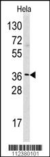 Anti-HNMT Rabbit Polyclonal Antibody