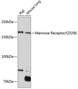 Western blot analysis of extracts of various cell lines, using Anti-Mannose Receptor Antibody [ARC0538] (A308512) at 1:1,000 dilution. The secondary antibody was Goat Anti-Rabbit IgG H&L Antibody (HRP) at 1:10,000 dilution.