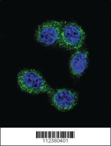 Anti-HNMT Rabbit Polyclonal Antibody