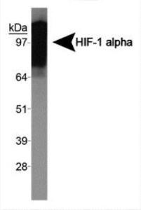 Anti-HIF1A Rabbit Polyclonal Antibody [clone: exon 10]