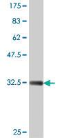 Anti-2610017G09Rik, ADP-GK Mouse Polyclonal Antibody