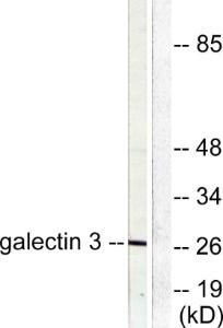 Western blot analysis of lysates from HeLa cells using Anti-Galectin 3 Antibody. The right hand lane represents a negative control, where the Antibody is blocked by the immunising peptide