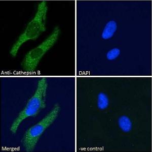 Anti-Cathepsin B (A121144) - Immunofluorescence analysis of paraformaldehyde fixed HeLa cells, permeabilized with 0.15% Triton. Primary incubation 1hr (10µg/ml) followed by Alexa Fluor 488 secondary antibody (2µg/ml), showing vesicle/cytoplasmic staining.