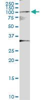 Anti-KAT7 Rabbit Polyclonal Antibody