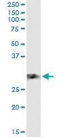 Anti-CD83 Antibody Pair