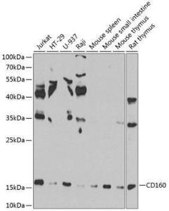 Western blot analysis of extracts of various cell lines, using Anti-CD160 Antibody (A10331) at 1:1000 dilution