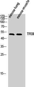 Anti-TFEB Rabbit Polyclonal Antibody