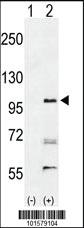 Anti-EPHA2 Rabbit Polyclonal Antibody