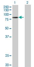 Anti-ADAM12 Mouse Polyclonal Antibody