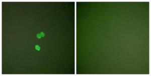 Immunofluorescence analysis of NIH/3T3 cells using Anti-Galectin 3 Antibody. The right hand panel represents a negative control, where the Antibody was pre-incubated with the immunising peptide