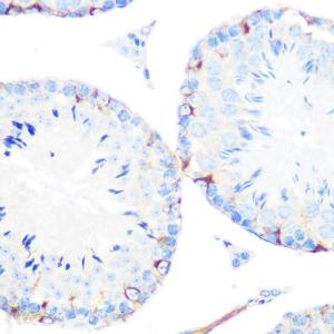 Immunohistochemistry analysis of paraffin-embedded mouse testis using Anti-gamma Catenin Antibody [ARC0909] (A305834) at a dilution of 1:100 (40x lens) Perform microwave antigen retrieval with 10 mM PBS buffer pH 72 before commencing with IHC staining protocol