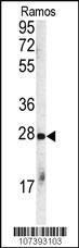 Anti-STUB1 Rabbit Polyclonal Antibody