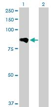 Anti-ADAM12 Rabbit Polyclonal Antibody