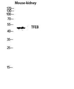 Anti-TFEB Rabbit Polyclonal Antibody