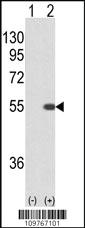 Anti-STK40 Rabbit Polyclonal Antibody [clone: 345CT19.6.2]