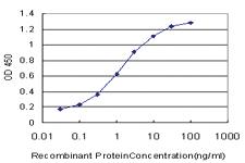 Anti-LHX4 Mouse Monoclonal Antibody [clone: 2B12]