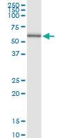 Anti-PPAT Polyclonal Antibody Pair