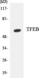 Western blot analysis of the lysates from Jurkat cells using Anti-TFEB Antibody