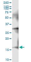 Anti-NDUFA13 Rabbit Polyclonal Antibody