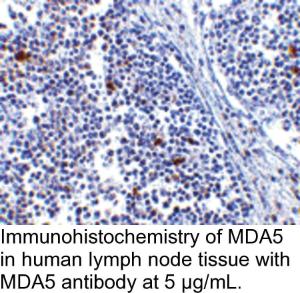 Anti-MDA5 Rabbit Polyclonal Antibody