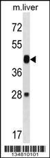 Anti-MAP2K6 Rabbit Polyclonal Antibody (APC (Allophycocyanin))