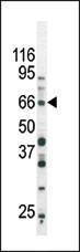 Anti-SMAD3 Rabbit Polyclonal Antibody (APC (Allophycocyanin))