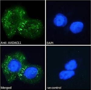 Anti-AADACL1 Antibody (A121150) - Immunofluorescence analysis of paraformaldehyde fixed A431 cells, permeabilized with 0.15% Triton. Primary incubation 1 hr (10 µg/ml) followed by Alexa Fluor 488 secondary Antibody (2 µg/ml), showing Endoplasmic reticulum staining.