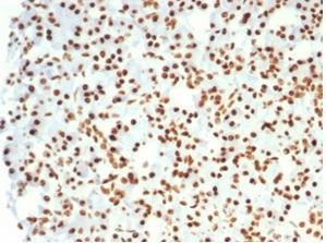 Anti-Nucleolin Rabbit Recombinant Antibody [clone: NCL/7014R]