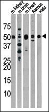 Anti-PARK2 Rabbit Polyclonal Antibody