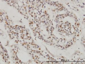 Anti-DPF2 Mouse Monoclonal Antibody [clone: 2F6]