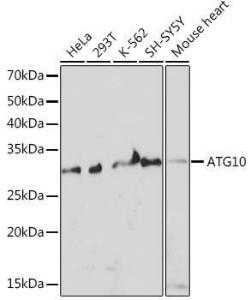 Western blot analysis of extracts of various cell lines, using Anti-ATG10 Antibody [ARC1425] (A308514) at 1:1,000 dilution