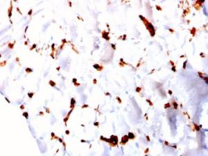 Immunohistochemical analysis of formalin-fixed, paraffin-embedded human skeletal muscle using Anti-FABP5 Antibody [CPTC-FABP5-3]