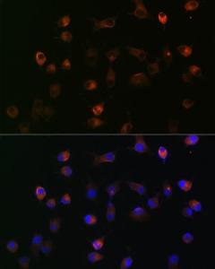 Immunofluorescence analysis of HeLa cells using Anti-gamma Catenin Antibody [ARC0909] (A305834) at a dilution of 1:100 (40x lens) DAPI was used to stain the cell nuclei (blue)