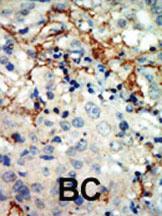 Anti-EPHA3 Rabbit Polyclonal Antibody