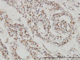 Anti-DPF2 Mouse Monoclonal Antibody [clone: 2F6]