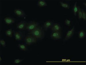 Anti-DPF2 Mouse Monoclonal Antibody [clone: 2F6]