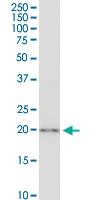 Anti-CSRP3 Mouse Monoclonal Antibody [clone: 6D2]