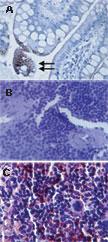 Anti-TLR3 Mouse Monoclonal Antibody [clone: 40C1285.6]