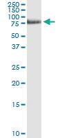 Anti-WASF3 Polyclonal Antibody Pair