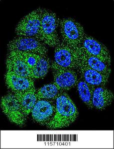 Anti-ABL1 Rabbit Polyclonal Antibody