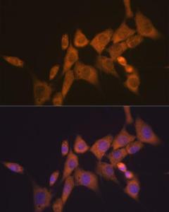 Immunofluorescence analysis of NIH-3T3 cells using Anti-ATG10 Antibody [ARC1425] (A308514) at a dilution of 1:100 (40X lens). DAPI was used to stain the cell nuclei (blue)