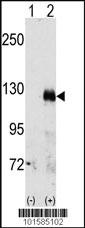 Anti-EPHA3 Rabbit Polyclonal Antibody