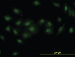 Anti-DPF2 Mouse Monoclonal Antibody [clone: 2F6]