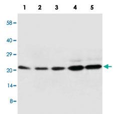 Anti-CDC42 Rabbit Polyclonal Antibody