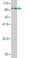 Anti-ASPSCR1 Mouse Monoclonal Antibody [clone: 3D10-1D11]